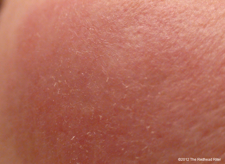 rash bumps on face